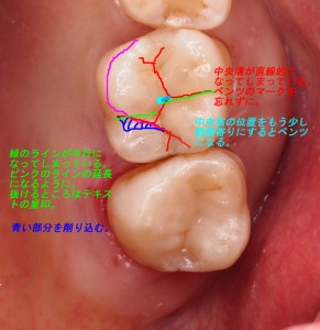 6番の修正箇所